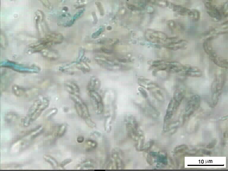 EUTYPA bathurstensis Hyde & Rappaz