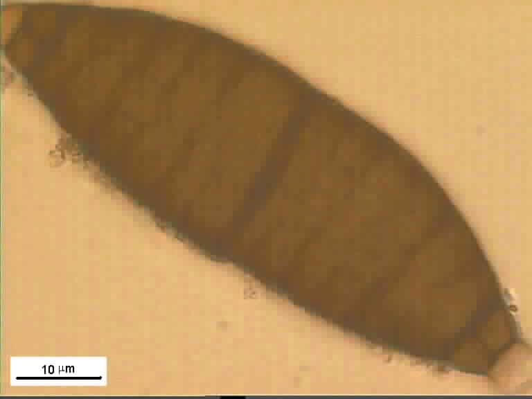 Aigialus grandis Kohlm