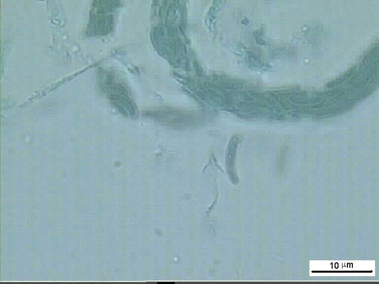 Cryptovalsa sp